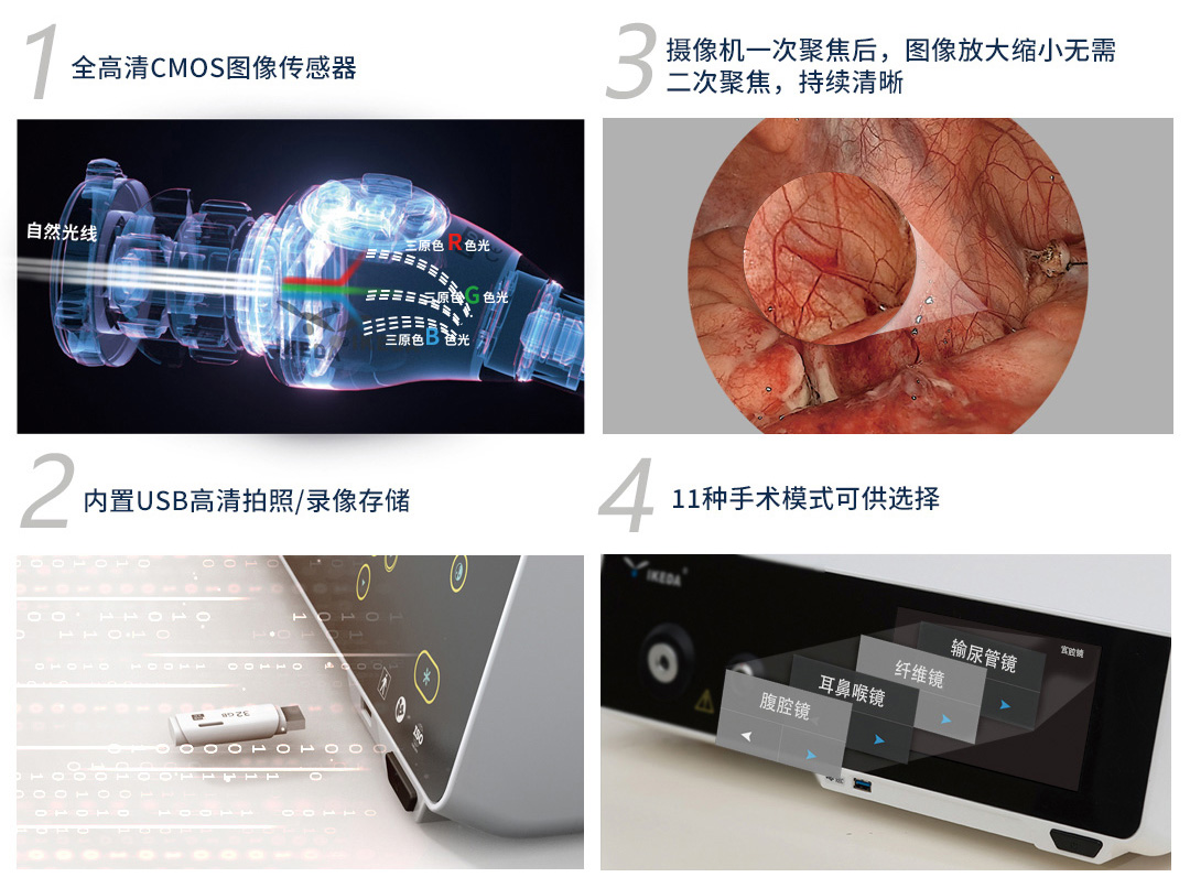 YKD-9103 一體化內窺鏡影像系統(tǒng)