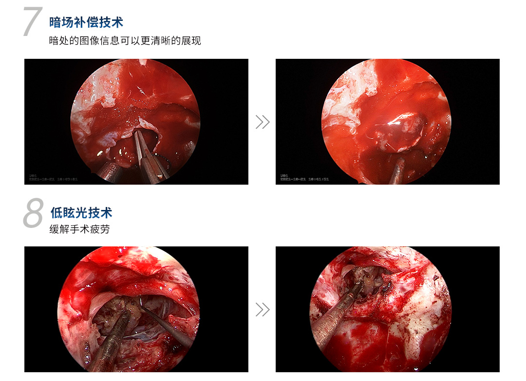 4K醫(yī)用內窺鏡攝像系統(tǒng) YKD-9210